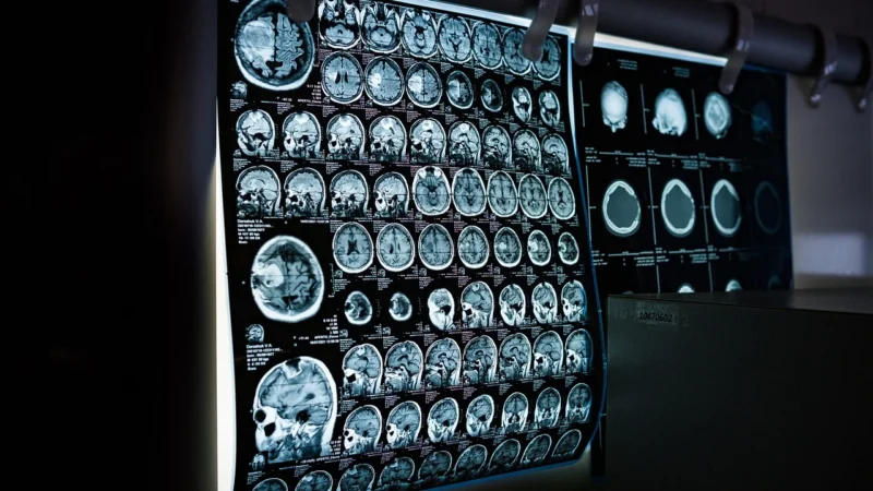 Nowoczesna diagnostyka dzięki rezonansowi magnetycznemu