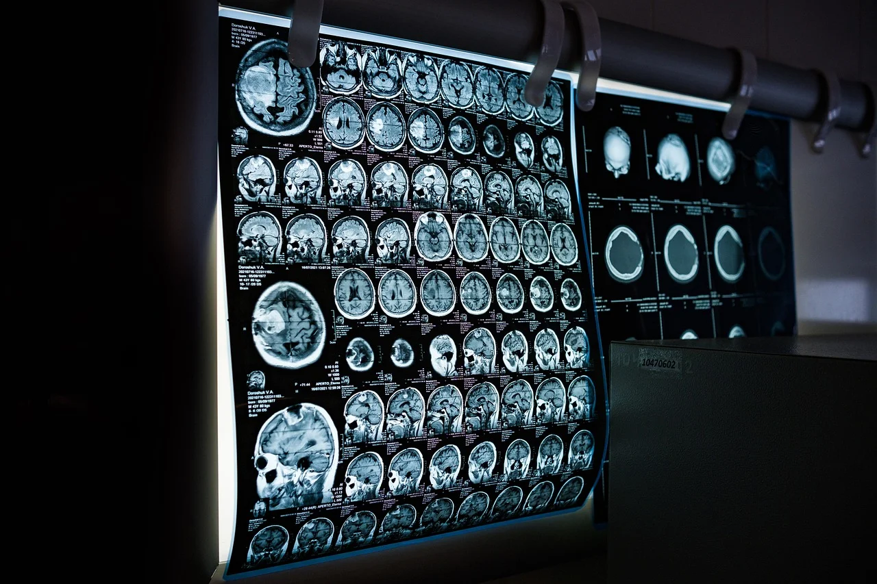 Nowoczesna diagnostyka dzięki rezonansowi magnetycznemu